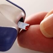 Blood glucose test ‘underestimates’ diabetes risk in South Asians | Nursing Times